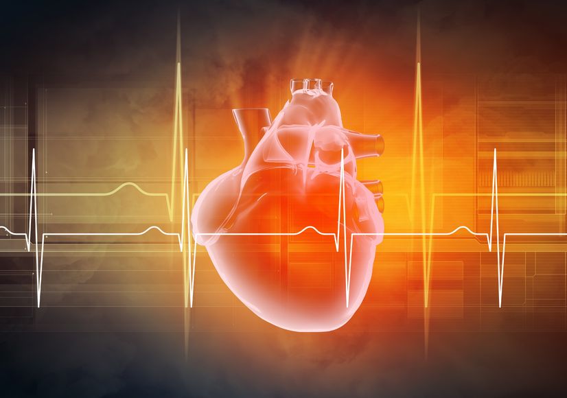 Underwent a Heart Procedure? You May Have Sleep Apnea