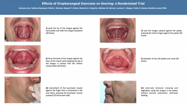 Source: American College of Chest Physicians and Vanessa Ieto